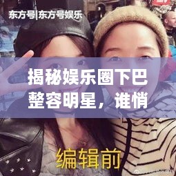 揭秘娛樂圈下巴整容明星，誰悄悄整過下巴？